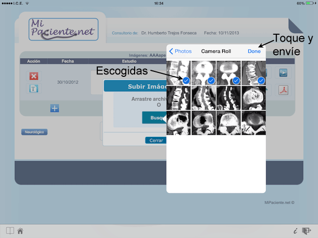 Escoja las imágenes a enviar al expediente médico en iPad
