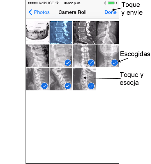 Escoja las imágenes a enviar al expediente médico en iPhone